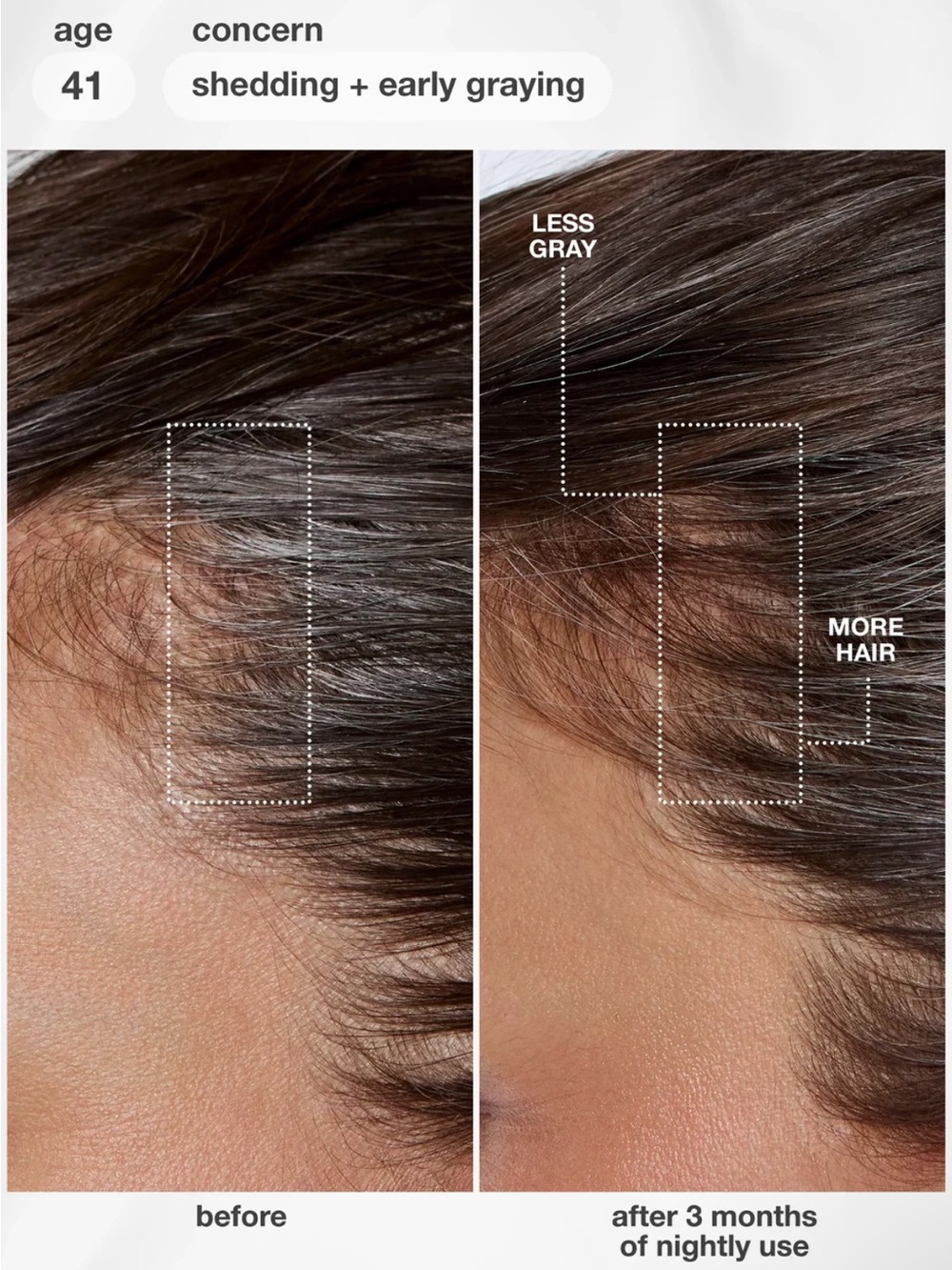 K18 FutureIQ™ Hair Longevity Serum for Graying, Thinning, & Scalp Aging - Picture 4 of 6